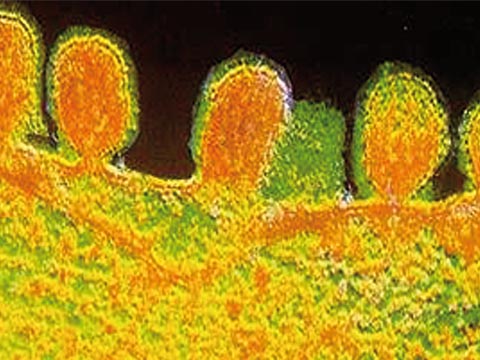 Imagem de microscopia eletrônica mostra momento em que vírus influenza comum sai de célula infectada (foto: Reprodução)